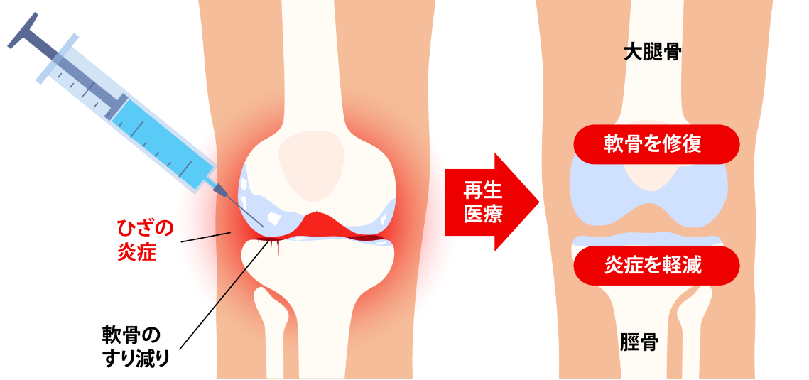 強力な鎮痛効果・長期的作用が期待できます