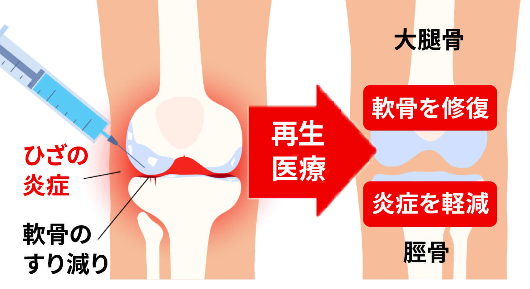 強力な鎮痛効果・長期的作用が期待できます