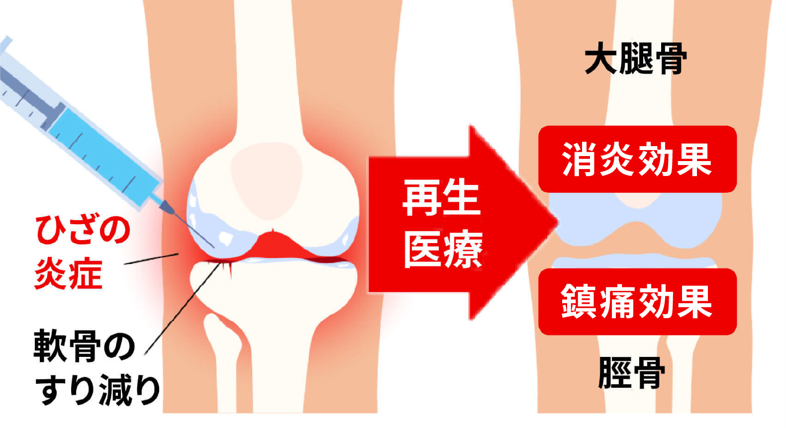 強力な鎮痛効果・長期的作用が期待できます