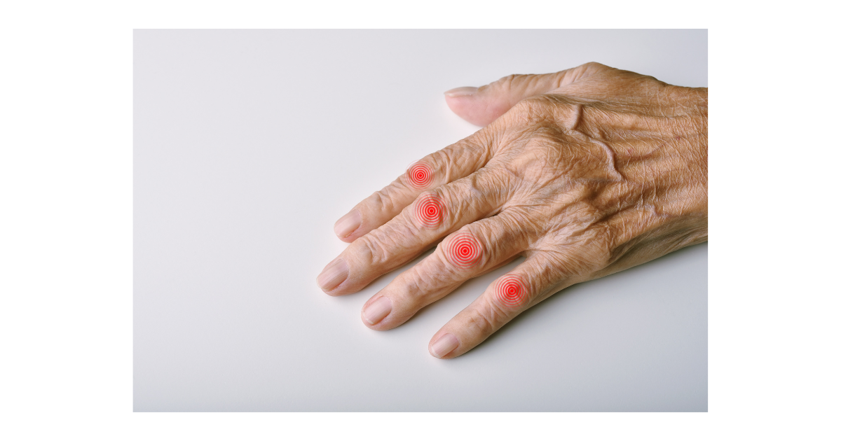 ブシャール結節の発症後やってはいけないこととは？原因や治療方法についても解説！