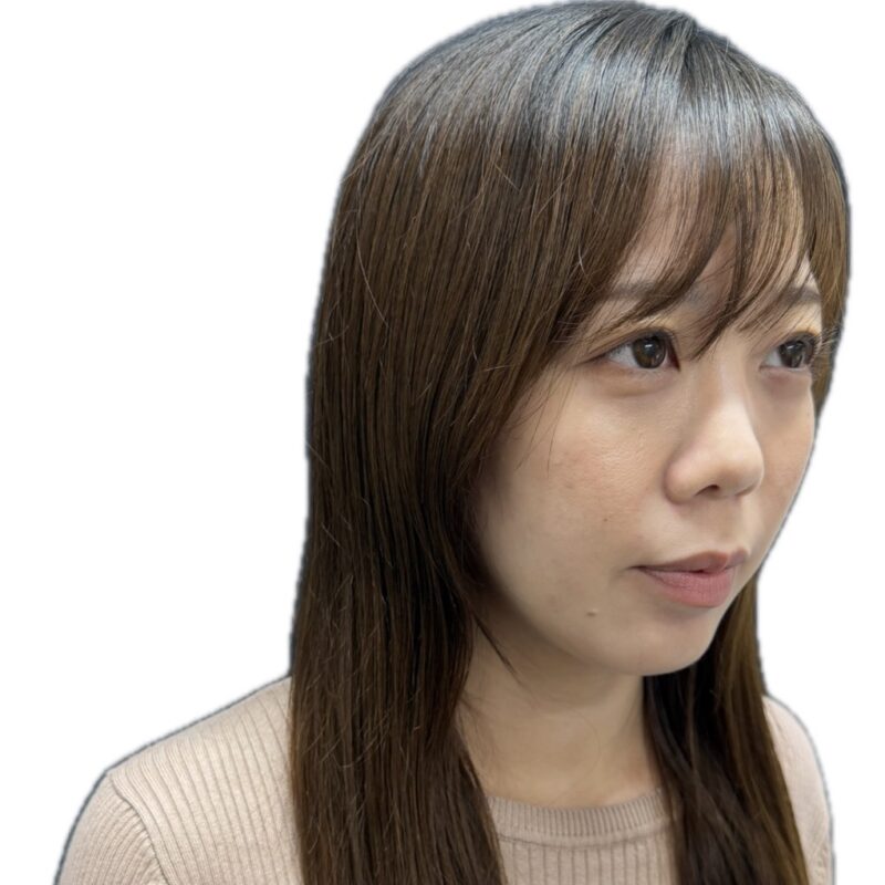 施術2週間後（斜めから）