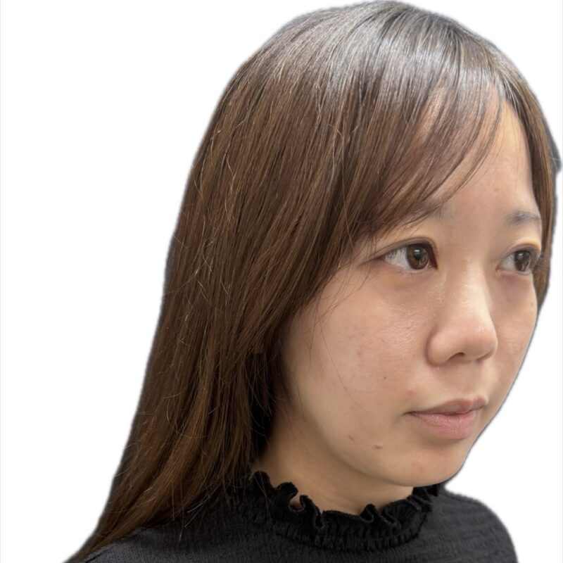 施術前（斜めから）