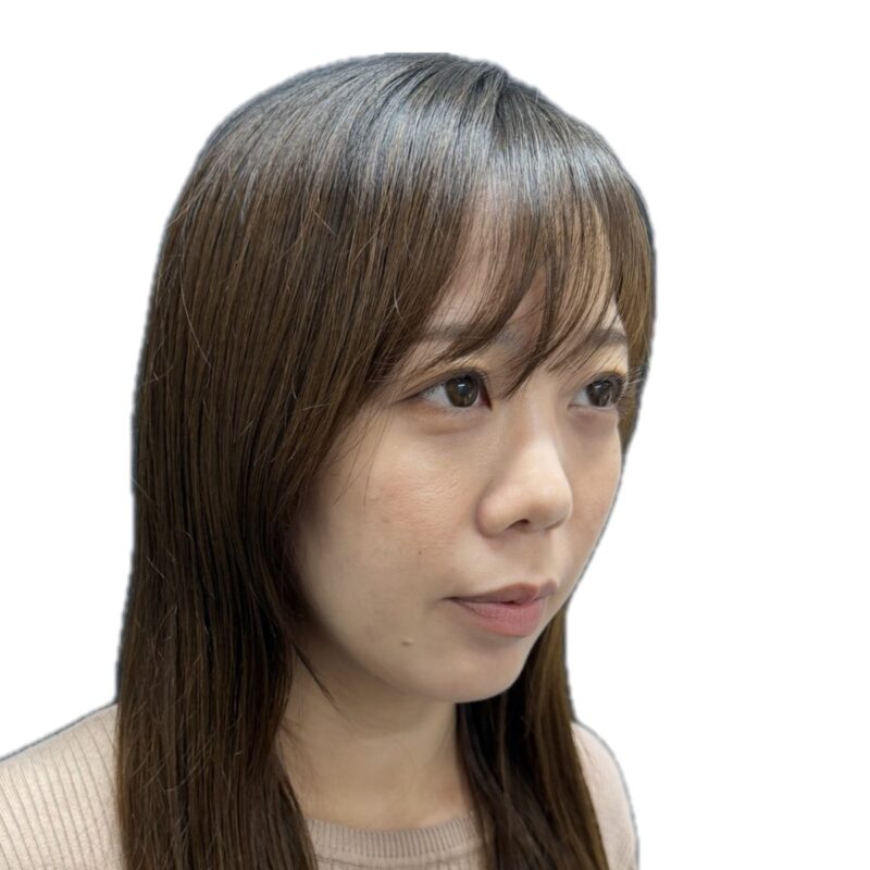 施術2週間後(斜めから)