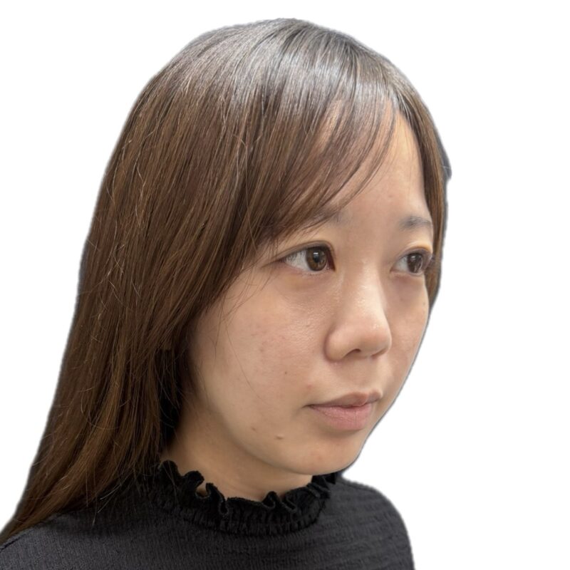 施術前(斜めから)